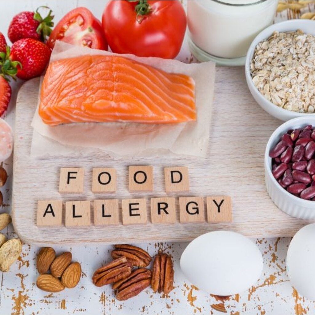 Symptoms Of Food Allergies And Sensitivities